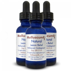 MolluscumRx - 3 Bottles