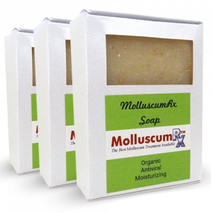 MolluscumRx Soap 3 Bars