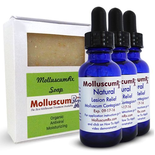 MolluscumRx - Soap & 3 Bottles